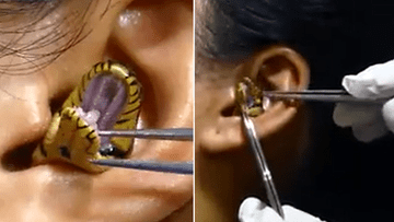 Індія: відео, де змія застрягла у вусі жінки